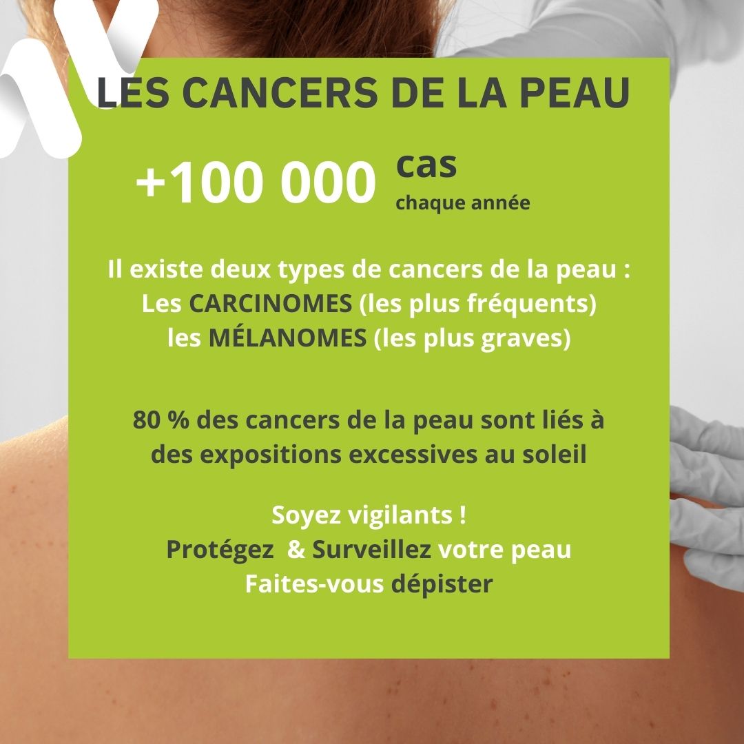 Prévention des cancers de la peau ! – Alternativ Pharma XV