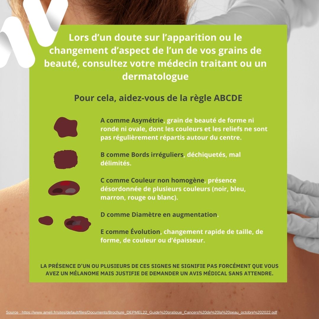 Prévention des cancers de la peau ! – Alternativ Pharma XV