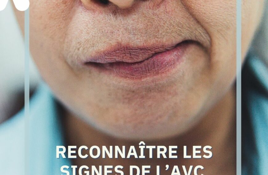 RECONNAÎTRE LES SIGNES DE L’AVC POUR AGIR VITE