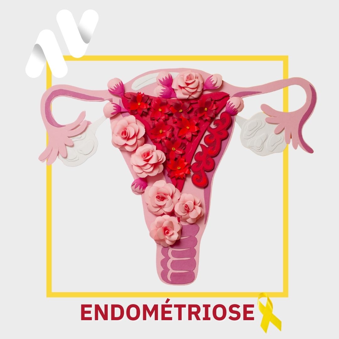 L’Endométriose