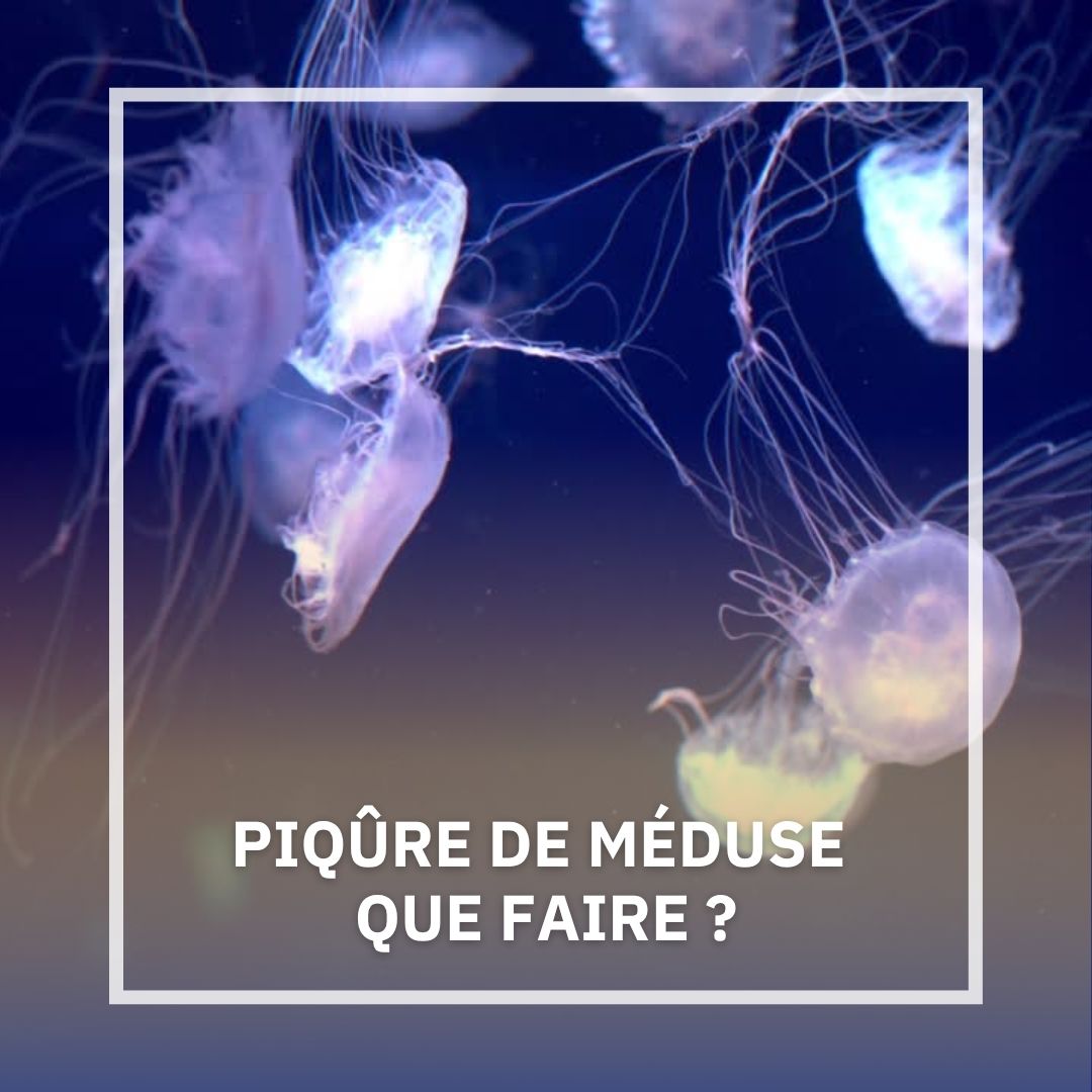 PIQÛRE DE MÉDUSE : QUE FAIRE ?