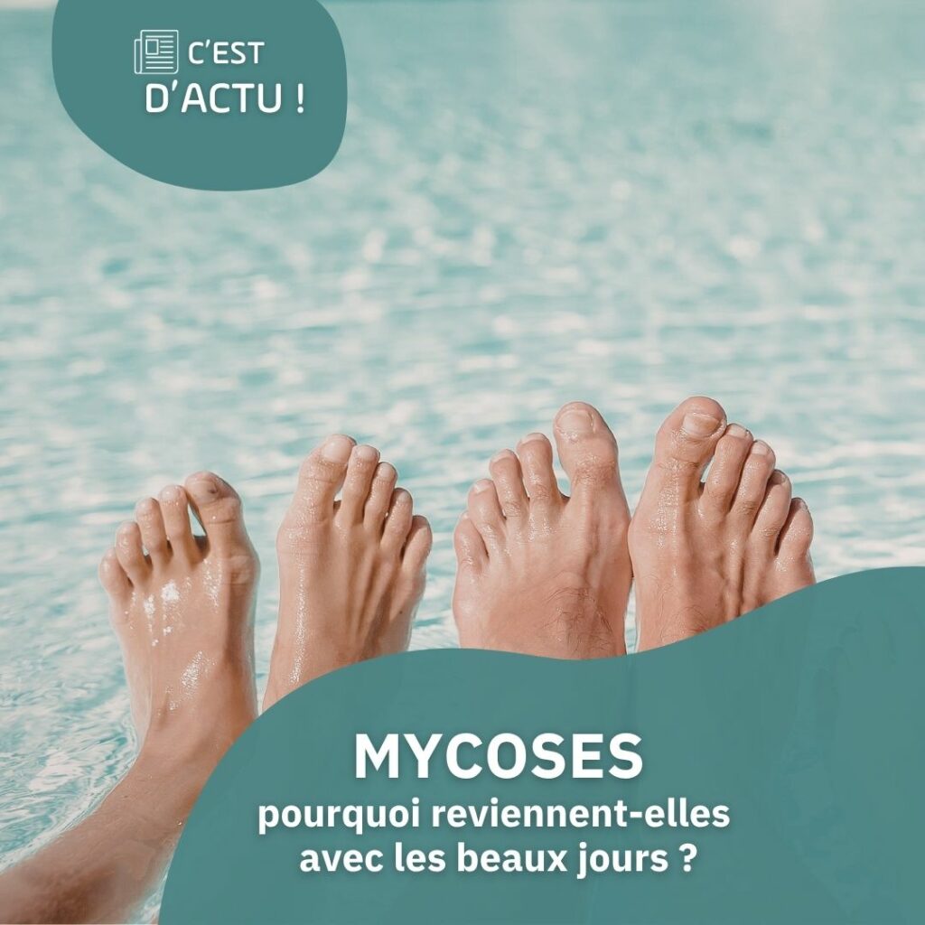 Mycoses : pourquoi reviennent-elles avec les beaux jours ?