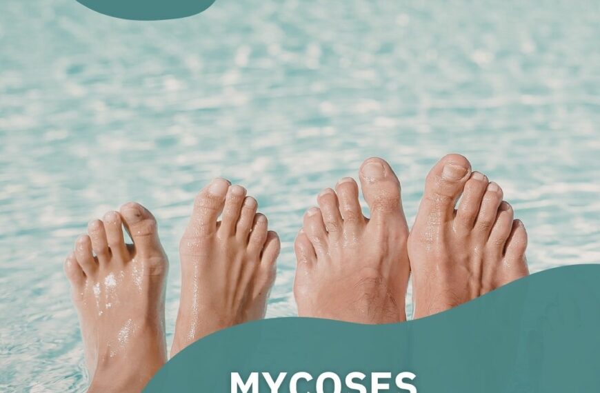 Mycoses : pourquoi reviennent-elles avec les beaux jours ?